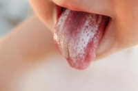 Tưa lưỡi trẻ sơ sinh: Dấu hiệu, nguyên nhân & cách cải thiện